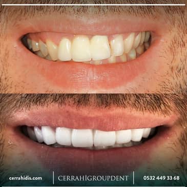 Slider image (2) Cerrahi Group Dental Clinic